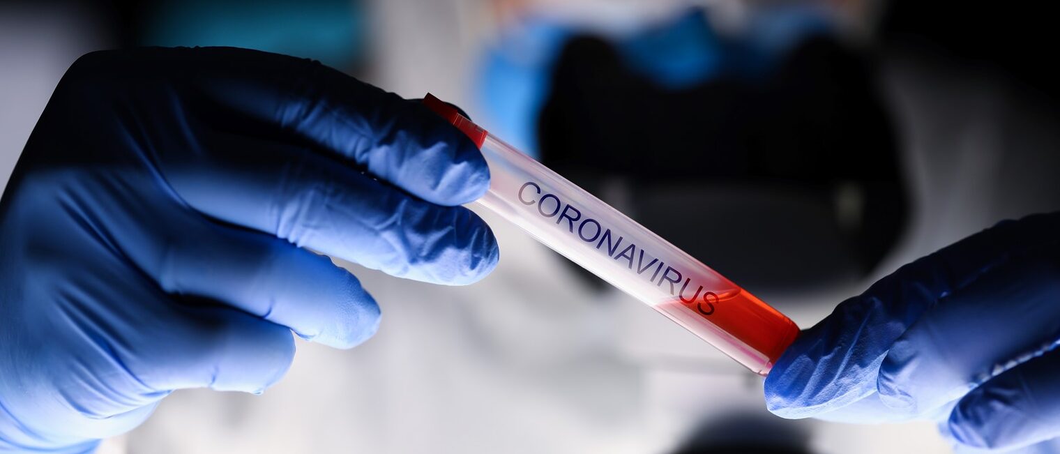 Male chemist hand in blue protective gloves hold test tube closeup background Schlagwort(e): coronavirus, sign, corona, virus, disease, ill, treatment, drug, blood, test, lab, chemistry, medical, medicine, hospital, hand, hold, tube, male, man, closeup, concept, infection, quarantine, china, chinese, spread, human, person, people, plasma, epidemic, flu, science, vaccine, panacea, vaccinations, analysis, virologist, study, problem, strain, immunity, mutation, pneumonia, fatal, symptoms, healthcare, doctor, nurse, coronavirus, sign, corona, virus, disease, ill, treatment, drug, blood, test, lab, chemistry, medical, medicine, hospital, hand, hold, tube, male, man, closeup, concept, infection, quarantine, china, chinese, spread, human, person, people, plasma, epidemic, flu, science, vaccine, panacea, vaccinations, analysis, virologist, study, problem, strain, immunity, mutation, pneumonia, fatal, symptoms, healthcare, doctor, nurse, Titelbild Coronavirus Informationen Handwerksbetriebe